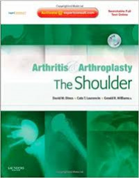 Arthritis and arthroplasty : the shoulder