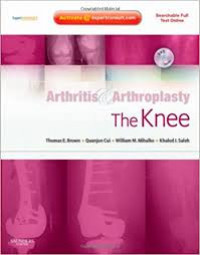 Arthritis and arthroplasty : the knee